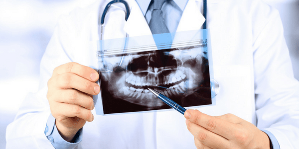 Are Dental X-Rays Safe?