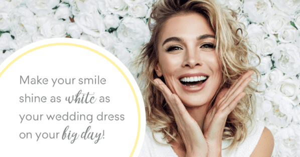 Wedding Planning – Getting Your Smile Ready for the Big Day